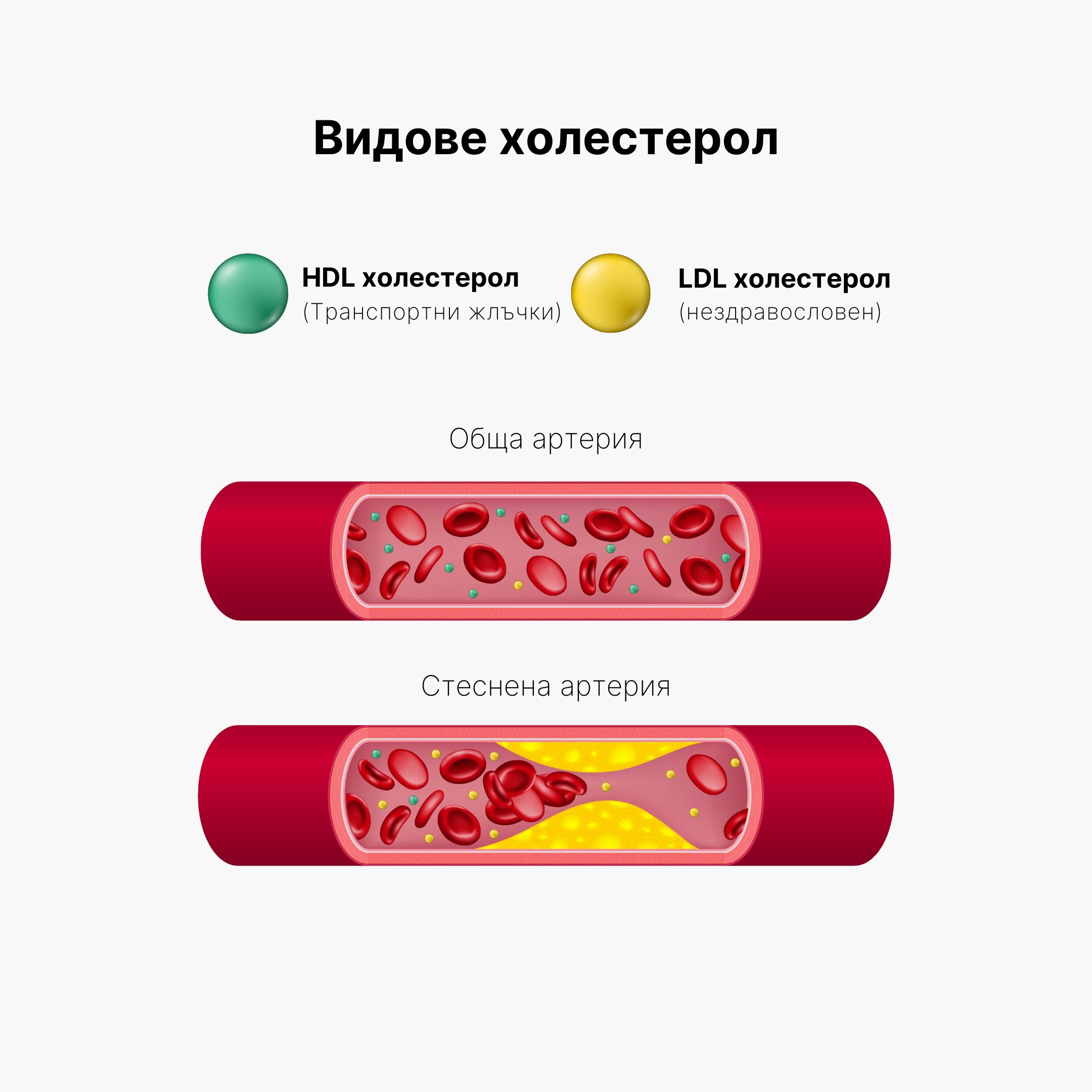 (Bulharština) Typy cholesterolu
